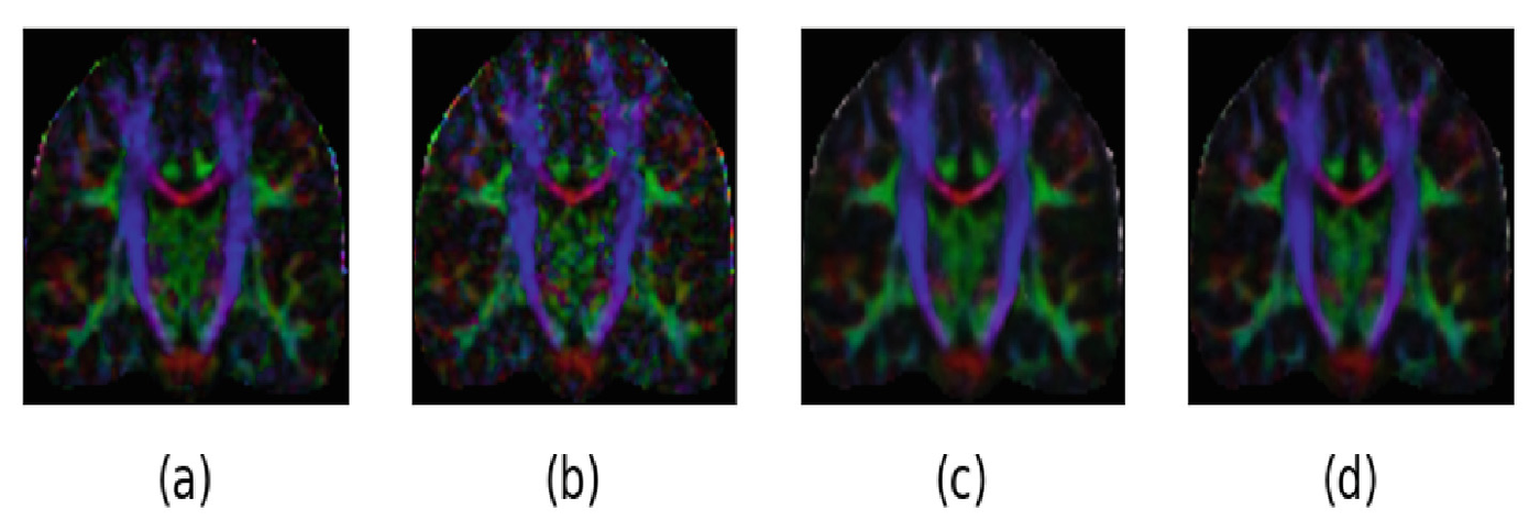 Four diffusion-encoded colour maps of the same brain slice side by side, showing white matter tracts in blue, green and red. The first is smooth, the second visibly grainy and speckled, and the last two are restored to near the smoothness of the first.