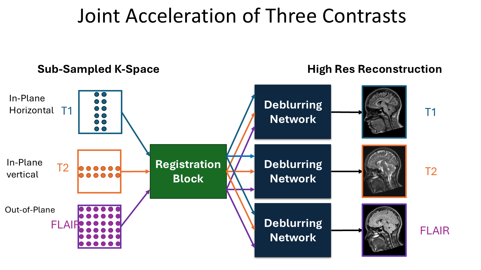Overview of the triple-modality deblurring framework: T1, T2 and FLAIR are undersampled along mutually orthogonal phase-encoding directions, jointly registered, and each reconstructed by a deblurring network into a high-resolution image.