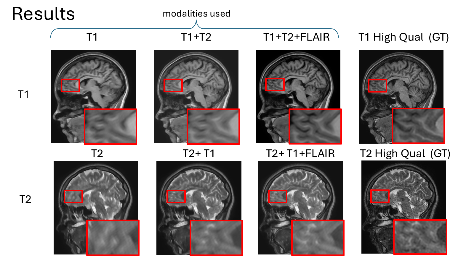 Grid of sagittal brain MRI reconstructions for T1 and T2 rows, comparing the accelerated single-contrast input against reconstructions using two and three modalities and the high-quality ground truth; magnified insets show progressively sharper detail.