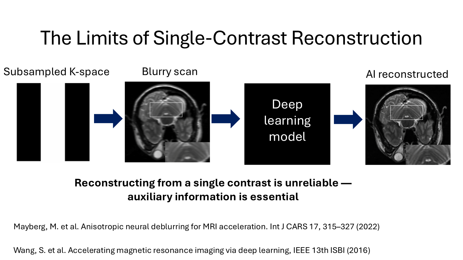 Pipeline showing a subsampled k-space producing a blurry scan that a deep-learning model reconstructs; the reconstruction from a single contrast remains imperfect.