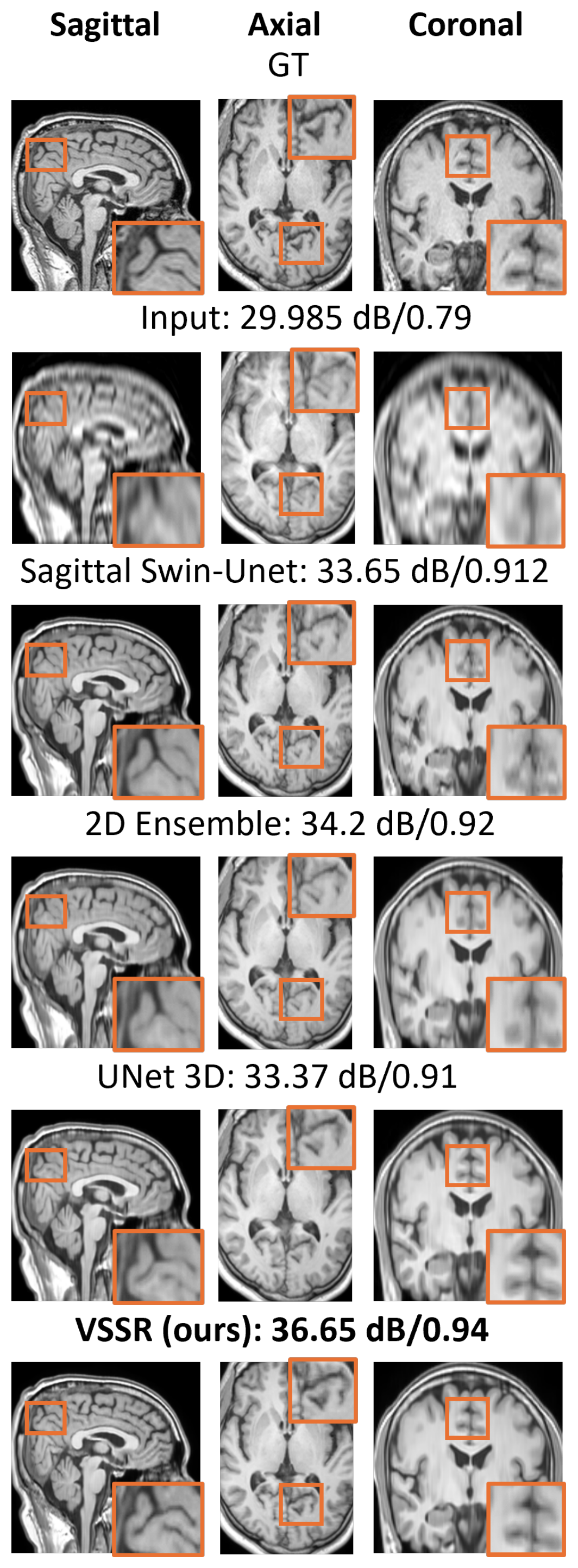 Six rows of brain MRI slices shown in sagittal, axial and coronal columns with magnified orange inset boxes: ground truth, the accelerated input, the sagittal Swin-UNet, the 2D ensemble, the 3D U-Net, and VSSR. Detail in the insets is sharpest and most consistent across the three planes for VSSR.
