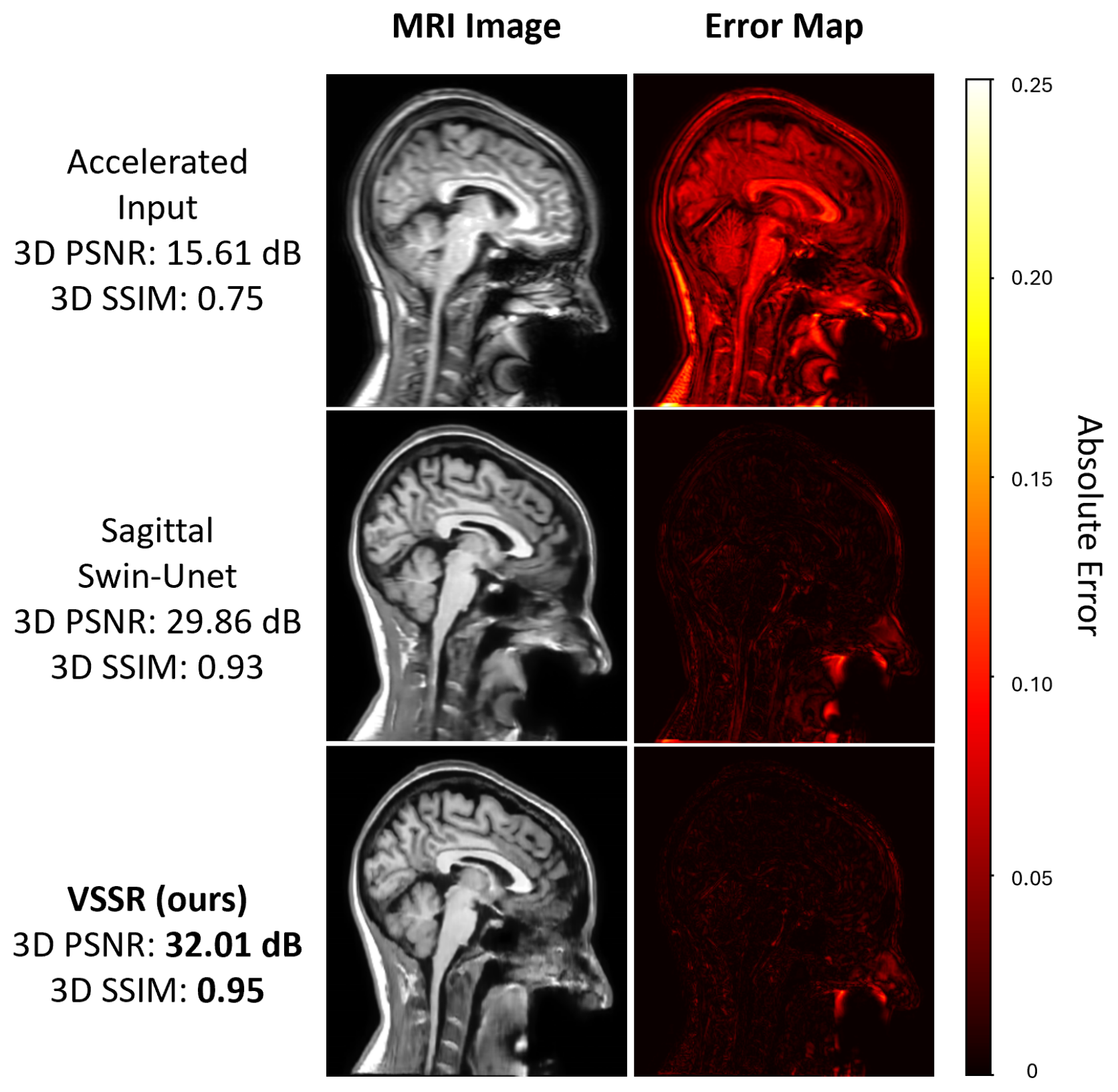 Three rows, each pairing a sagittal brain MRI with its absolute error map against the fully sampled reference: the accelerated input at 15.61 dB, the sagittal Swin-UNet at 29.86 dB, and VSSR at 32.01 dB. The error maps grow progressively darker, with VSSR showing the least residual error.