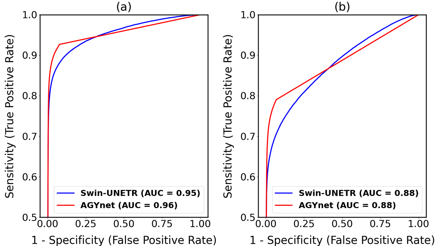 Two ROC plots of sensitivity against one minus specificity. For Broca both curves rise steeply, reaching an area under the curve of 0.95 for Swin-UNETR and 0.96 for AGYnet. For Wernicke both architectures reach 0.88.