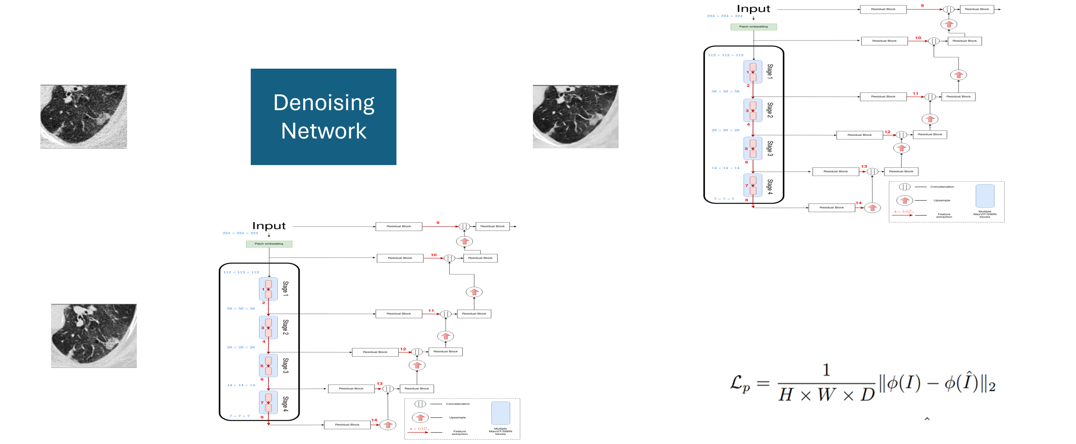 Denoising framework: an ultra-low-dose patch passes through the denoising network; the denoised patch and the co-registered ground-truth patch are each embedded by a transformer, and the perceptual loss is the L2 distance between their embeddings