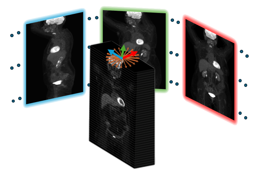 Illustration of a 3D PET volume drawn as a stack of slices, with three two-dimensional whole-body projection images fanning out from it, framed in cyan, green and red to mark the 0, 45 and 90 degree viewing angles.