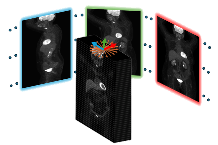 A 3D PET volume with three whole-body maximum intensity projections fanning out from it, framed in cyan, green and red to mark different viewing angles