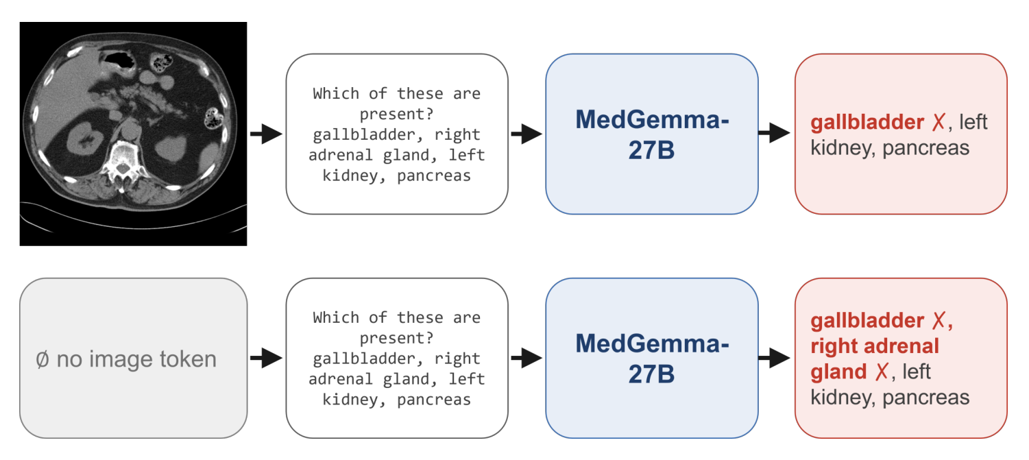 Two rows. Top: an abdominal CT slice and the prompt 'Which of these are present? gallbladder, right adrenal gland, left kidney, pancreas' go into MedGemma-27B, which answers gallbladder — marked wrong — left kidney, pancreas. Bottom: the same prompt with no image token at all yields gallbladder and right adrenal gland, both marked wrong, plus left kidney and pancreas.